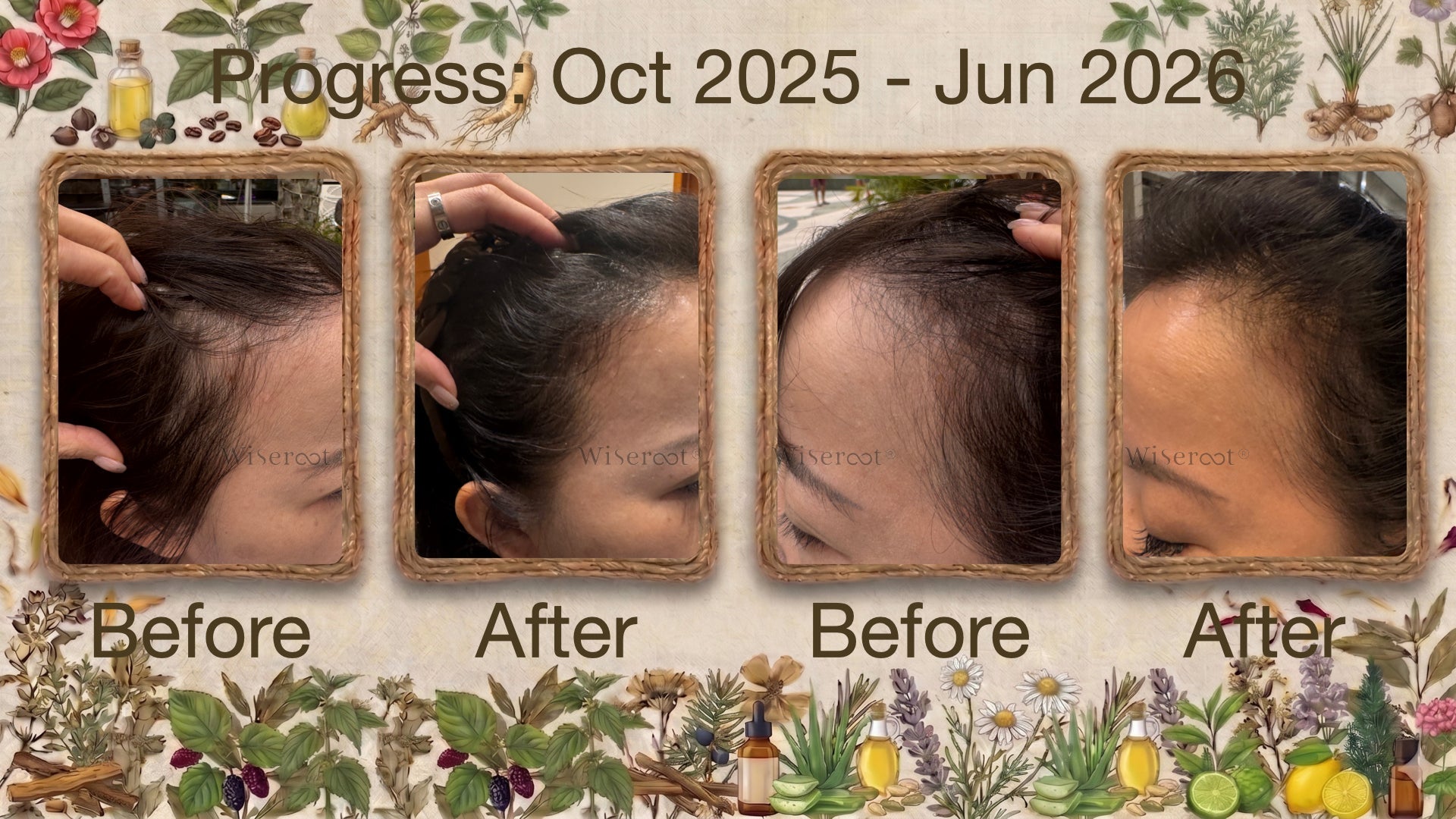 "Fine Hair, Postpartum Shedding, and a High-Stress Job" — My Hair Finally Has Volume Again